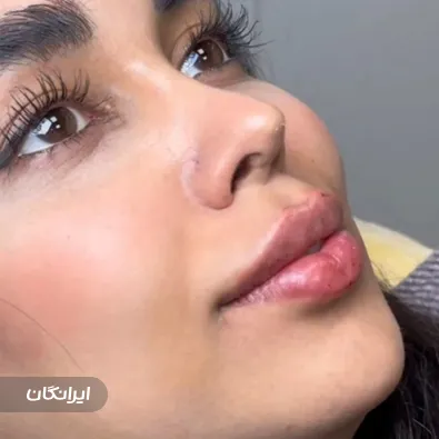 کلینیک زیبایی مهوان