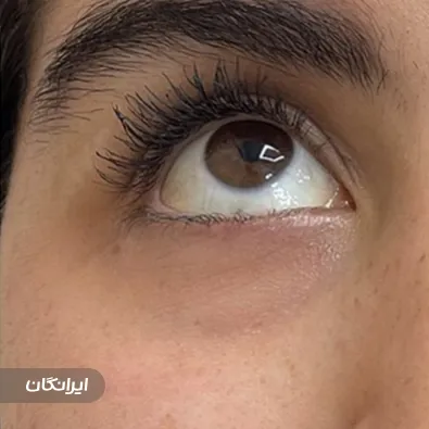 کلینیک زیبایی دکتر لیلی فروزش