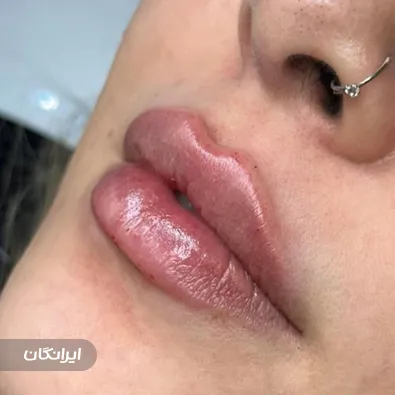 کلینیک زیبایی رونیل