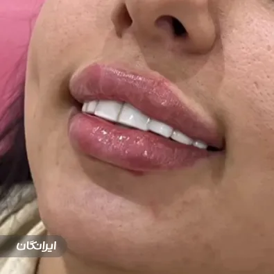 کلینیک زیبایی دکتر حسن اکبرزاده