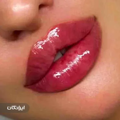 کلینیک زیبایی دکتر کیان کوشا