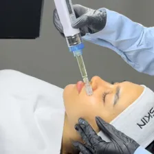 فیشیالیست المیرا ارغوانی