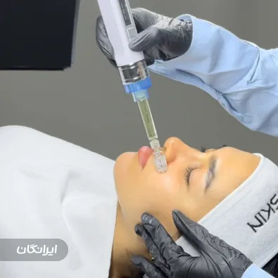 فیشیالیست المیرا ارغوانی