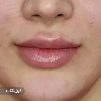 کلینیک زیبایی بنیتا