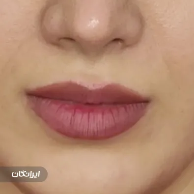 کلینیک زیبایی بنیتا