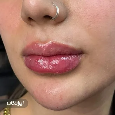 کلینیک زیبایی بنیتا