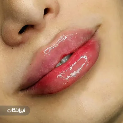 کلینیک زیبایی بنیتا