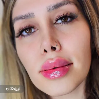 کلینیک زیبایی بنیتا