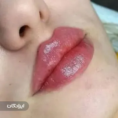 کلینیک زیبایی نیل لایف