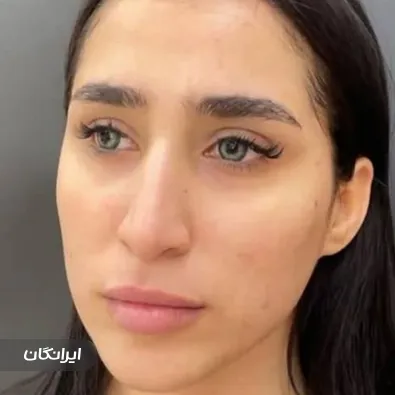 کلینیک زیبایی نیل لایف