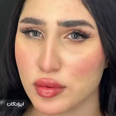 کلینیک زیبایی نیل لایف