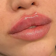 کلینیک زیبایی پیوند