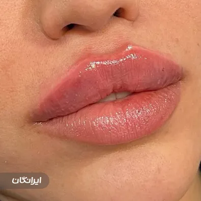 کلینیک زیبایی پیوند