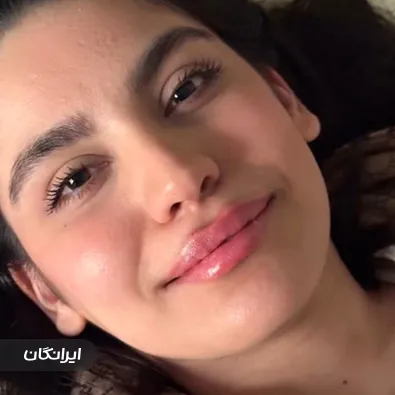 کلینیک زیبایی نیلوفر