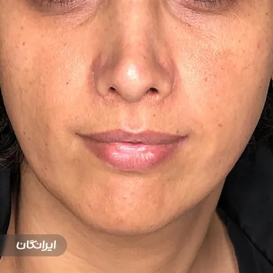 کلینیک زیبایی لبخند شیرین