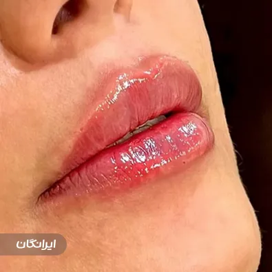 کلینیک زیبایی دکتر پوریا نقشه چی