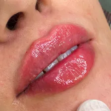 کلینیک زیبایی دکتر پوریا نقشه چی