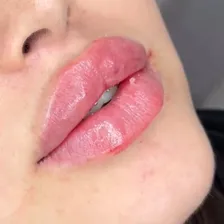 کلینیک زیبایی دکتر الهام فلسفی