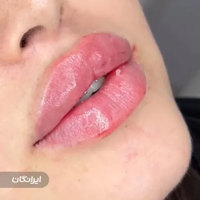 کلینیک زیبایی دکتر الهام فلسفی