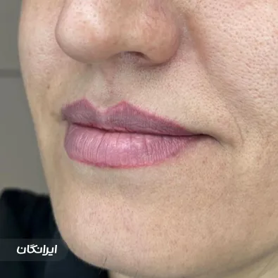 کلینیک زیبایی دکتر الهام فلسفی