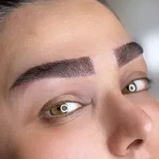 کلینیک کاشت مو درسا