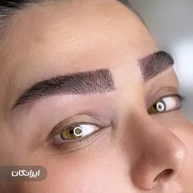 کلینیک کاشت مو درسا