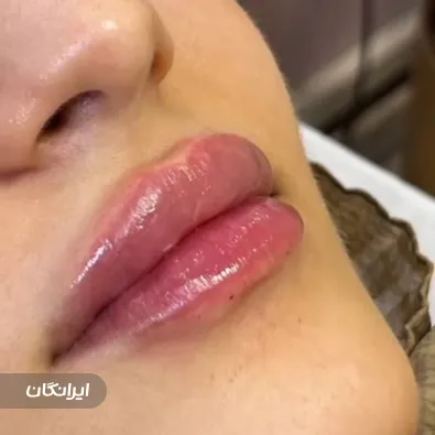 کلینیک زیبایی دکتر الهه رنگیانی