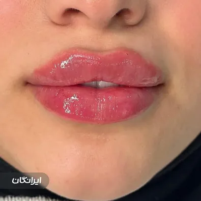 دکتر شیوا قندی ها