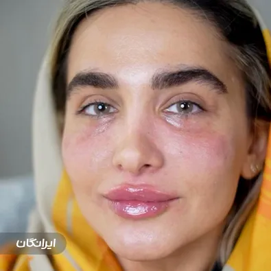 کلینیک زیبایی هانیس