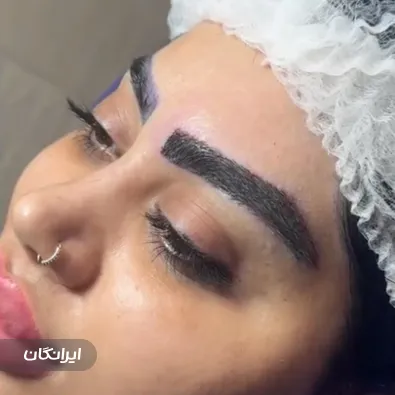 تکنسین کاشت مو و ابرو فرزانه محمدپور