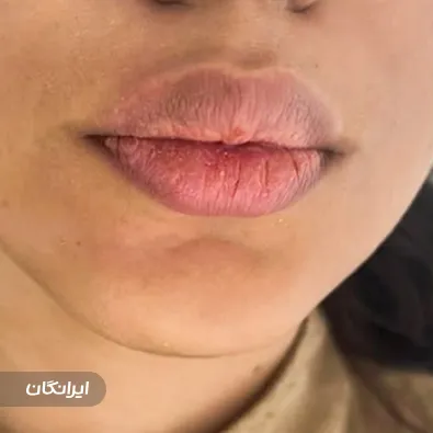 کلینیک زیبایی لیا