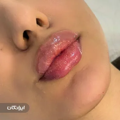 کلینیک زیبایی لیا