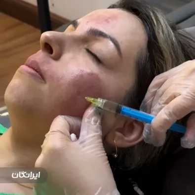 فیشیالیست نازنین وحدت