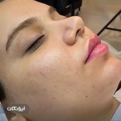 مرکز خدمات پوستی زارع پور