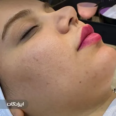 مرکز خدمات پوستی زارع پور