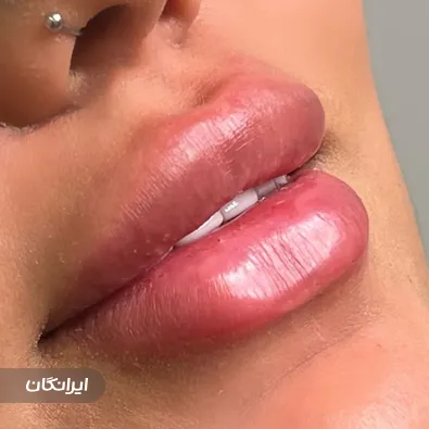 کلینیک زیبایی لیفت پلاس