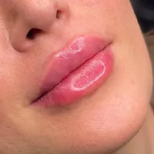 کلینیک زیبایی لیفت پلاس