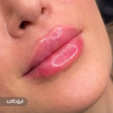 کلینیک زیبایی لیفت پلاس