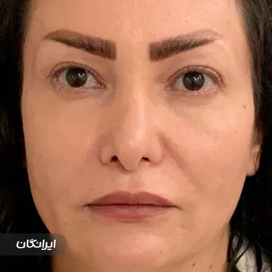 کلینیک زیبایی دکتر علی الستی