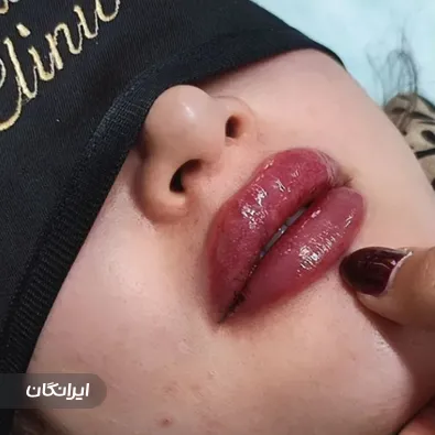 کلینیک زیبایی دکتر سپیده سعادتی