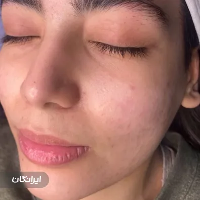 مرکز خدمات پوستی نرگس