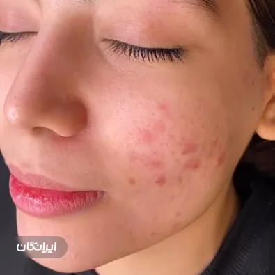 مرکز خدمات پوستی نرگس