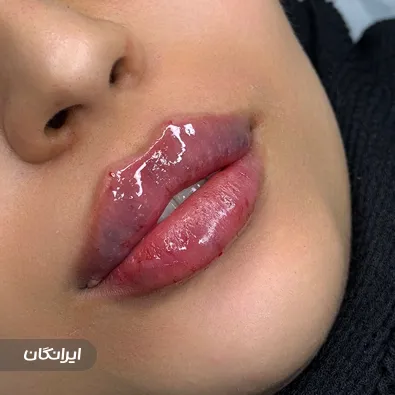 کلینیک زیبایی دکتر بیتا غلامی