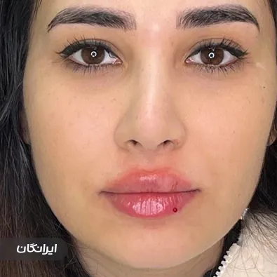 کلینیک زیبایی بهاربیوتی