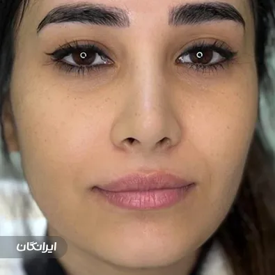 کلینیک زیبایی بهاربیوتی