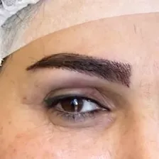 کلینیک کاشت مو مروا