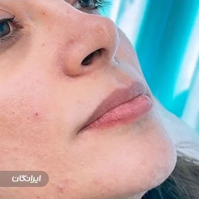 کلینیک زیبایی ماهشید