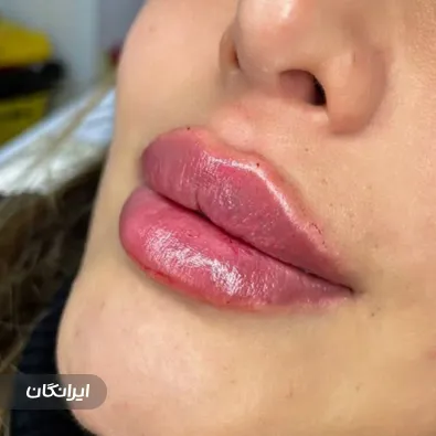 کلینیک زیبایی ماهشید