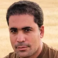 کلینیک کاشت مو بهروزی