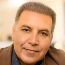 کارشناس کاشت مو چنور مرادی